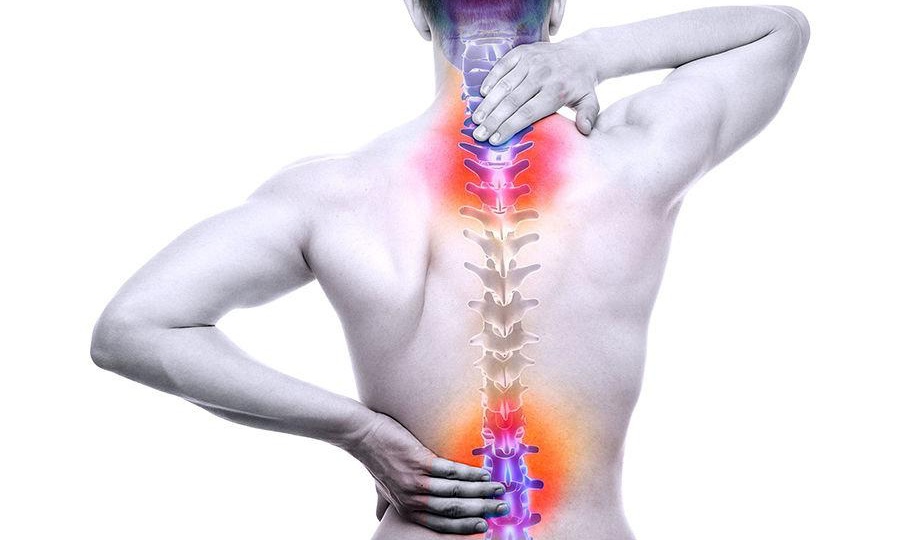 6 sự thật về THOÁT VỊ ĐĨA ĐỆM mà không phải ai cũng biết?