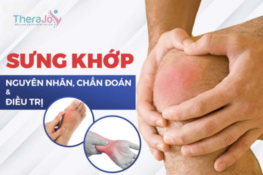 SƯNG ĐAU KHỚP – Nguyên nhân và Điều trị