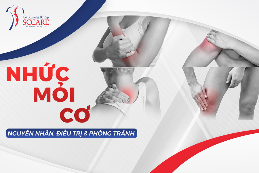 NHỨC MỎI CƠ: Nguyên nhân và Cách điều trị
